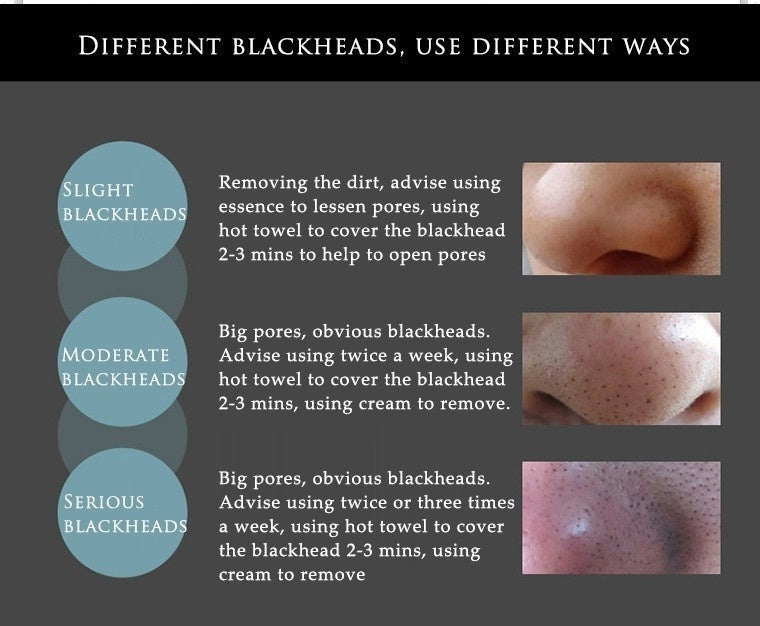 LUMIVO Bamboo Charcoal Blackhead Remover